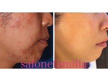 サローネファミリア(SALONE FAMILIA)/敏感肌だってご覧の通り