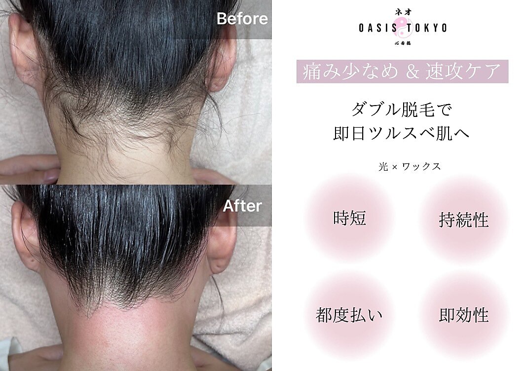 ネオオアシス トウキョウ(ネオOASIS TOKYO)｜ホットペッパービューティー