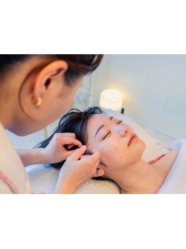 鍼灸施術を受けたい