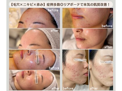 ルアナ(Luana)の写真
