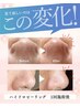【フェイシャル施術に＋】毛穴リセット洗浄OP ¥6,800