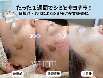 エングラッシー(en glassy)