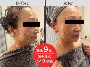 メディカルフェイシャルエステティック サロン ド ヴェリテ(VERITE)/