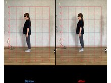 リード整骨院(LEAD整骨院)/姿勢改善、猫背、反り腰