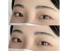 シャトン(Chaton)/ラッシュリフト