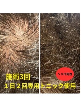 エヌクリア(N CLEAR)の写真/グリーンピールは頭皮環境を整え、健やかな髪を育てます！ハーブの力清潔感あふれる印象へ♪