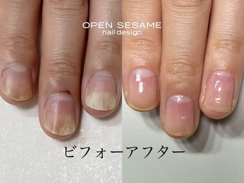 オープンセサミ 練馬/3ヵ月集中美爪育成コース/全8回
