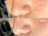 《古い角質&黒ずみに》眉毛スタイリング+【選べるフェイスWAX1箇所】￥7800