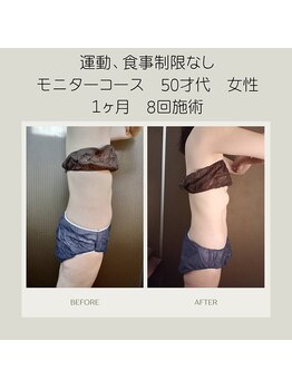 キセキ KISEKI リラクゼーション/最強×最新マシンでサイズダウン