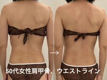 ヴィセラ(Vicella)/身体の流れ→ラインもスッキリ！