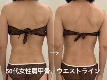 ヴィセラ(Vicella)/身体の流れ→ラインもスッキリ!