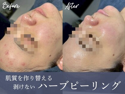 エミーニー(emiiny)の写真