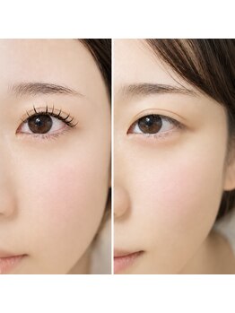 エオス(Eos)の写真/《ご新規様クーポンあり〇》リペアシステムがお得☆フラット/フラットダブル/バインドロック