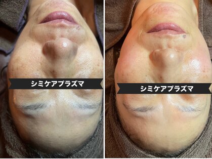 サロン フェリシア(salon Felicia)の写真