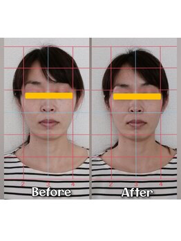 ぷめはな整体/小顔矯正　1回の変化♪