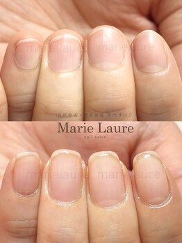 マリーロール 淀屋橋本店(Marie Laure)/自爪育成/深爪矯正/ネイルケア