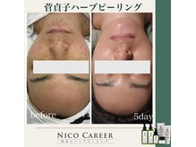 カリア北千里店の雰囲気（菅貞子ハーブピーリング）
