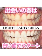 ライトビューティー 銀座店(LightBeauty)/東銀座 ホワイトニング 症例写真