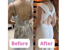 ボディキュア ブライダル美容整体 大阪梅田/【巻き肩・猫背改善】姿勢美人に