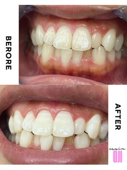 エクシアホワイトニング 王寺店/