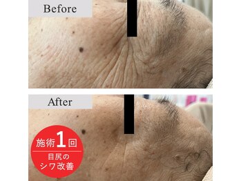 メディカルフェイシャルエステティック サロン ド ヴェリテ(VERITE)/