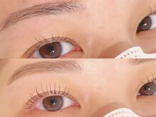 GRAN EYE 新秋津店【グランアイ】/ Before＆After