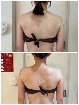 エイシスグロウ(asis glow.)/効果写真