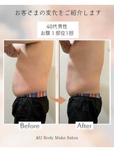 アンドユー(&U)/