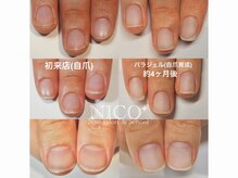 ニコプラス 大橋店(NICO+)/自爪育成中（自爪風仕上げ）