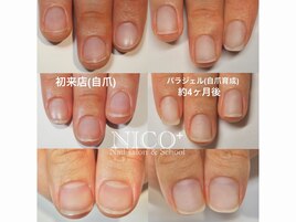 自爪育成中（自爪風仕上げ）