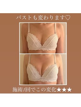 ウララカ(uraraka)/変わらないバストは無い！