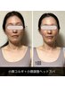 【黄金バランスがコルギで叶う☆小顔リフト】小顔コルギ＋ヘッドスパ(60分)