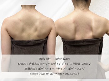 エメ 名古屋栄店(aimer)/BodyCare <痩身・代謝アップ>