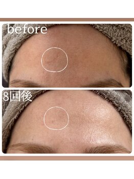 ルシアス(LUCIAS)/プロセルセラピーズ