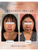 すなお 溝の口(Sunao)/【小顔コルギ】30代お客様