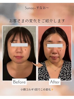 すなお 溝の口(Sunao)/【小顔コルギ】30代お客様