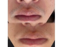 男性のお客様も多数ご利用♪