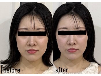 ニュート 表参道 外苑前(NUUT)/【モニター割募集♪】