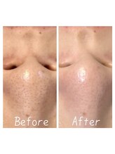 シャルム ココ 八尾店(Charme coco)