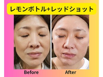 アン 銀座(ann)/レモンボトル+レッドショット