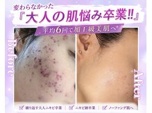 ノア 新宿(Noa)