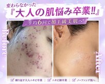 ノア 新宿(Noa)