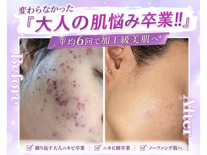 ノア 新宿(Noa)の写真