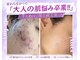 ノア 新宿(Noa)の写真