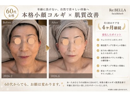 リベラ(Re:BELLA)の写真