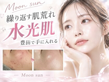 ムーンサン(Moon sun)の写真