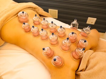 ヴィオラ(Viola)/カッピング