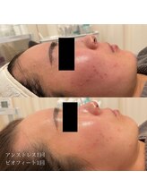 エクラ(eclat)/クリスティーナ