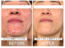 ラディアント(Radiant)/エンビロン - ビフォーアフター