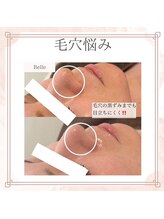 ベル(Belle)/【艶玉肌セルマン】